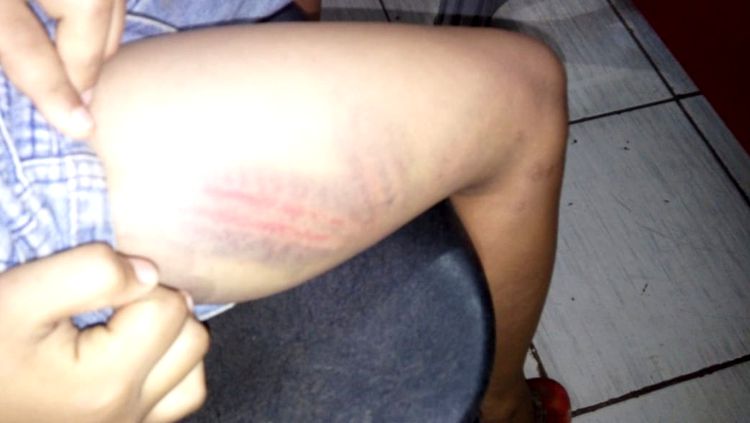 Adolescente é agredida a pauladas por soltar cachorro preso pelo namorado Adolescente é agredida a pauladas por soltar cachorro preso pelo namorado