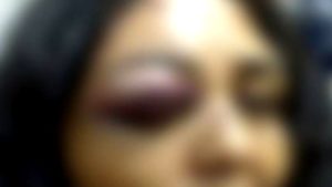 Mãe é espancada após filho ler mensagem da ex-mulher no Facebook Mãe é espancada após filho ler mensagem da ex-mulher no Facebook