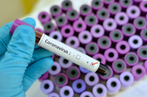 Rondônia tem quase 3 mil infectados e 106 mortes por coronavírus Rondônia tem quase 3 mil infectados e 106 mortes por coronavírus