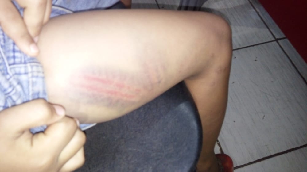 Mãe é presa após surrar a filha com fio por ter saído de casa Mãe é presa após surrar a filha com fio por ter saído de casa