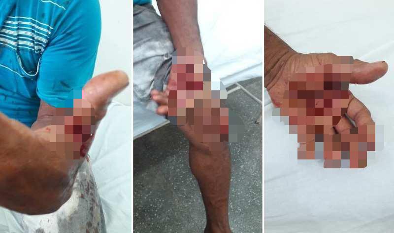 Idoso é esfaqueado durante roubo em residência e criminoso é preso Idoso é esfaqueado durante roubo em residência e criminoso é preso