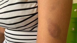 Menina de 13 anos é espancada por ladrões ao reagir roubo de celular Menina de 13 anos é espancada por ladrões ao reagir roubo de celular