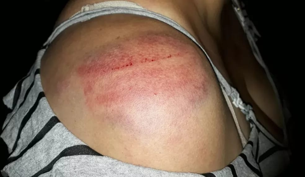 Esposa é socorrida para a UPA após ser brutalmente agredida pelo marido Esposa é socorrida para a UPA após ser brutalmente agredida pelo marido