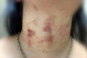 Homem tenta matar mulher a facadas e asfixiada no sofá de casa Homem tenta matar mulher a facadas e asfixiada no sofá de casa