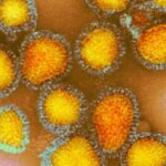 PREOCUPANTE – Sesau confirma 4 mortes por gripe em Rondônia